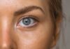 Top Benefits of Eyelid Surgery Eyelid Surgery