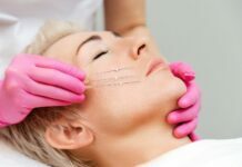 Reasons Why You Should Consider Threadlift Threadlift