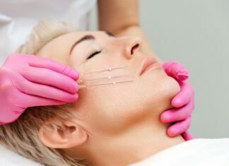 Reasons Why You Should Consider Threadlift Threadlift