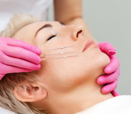 Reasons Why You Should Consider Threadlift Threadlift