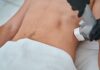 Answers To Your Frequent Questions About Coolsculpting Coolsculpting
