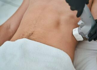 Answers To Your Frequent Questions About Coolsculpting Coolsculpting