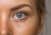 5 Ways Your Dermatologist Can Help You Prevent Skin Cancer Skin Cancer
