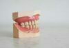 An Overview of Gingivitis and Periodontitis Gingivitis and Periodontitis