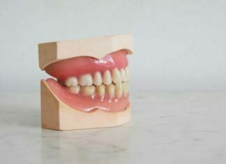An Overview of Gingivitis and Periodontitis Gingivitis and Periodontitis