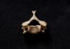 When You Should Consider Visiting Your Spine Specialist Spine Specialist