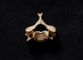 When You Should Consider Visiting Your Spine Specialist Spine Specialist