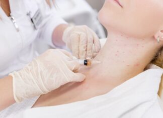 Reasons Why You May Need a Mini Necklift Necklift