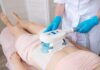 5 Situations Where You Might Need to Consider CoolSculpting CoolSculpting