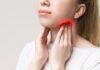 Tonsillitis: Symptom, Causes, Risk Factors, and Prevention Tonsils