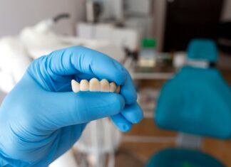 What To Expect After a Dental Bridge Procedure Done in Sugar Land? Dental Bridge