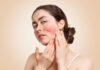 When Should I Go for Rosacea Treatment? Rosacea Treatment