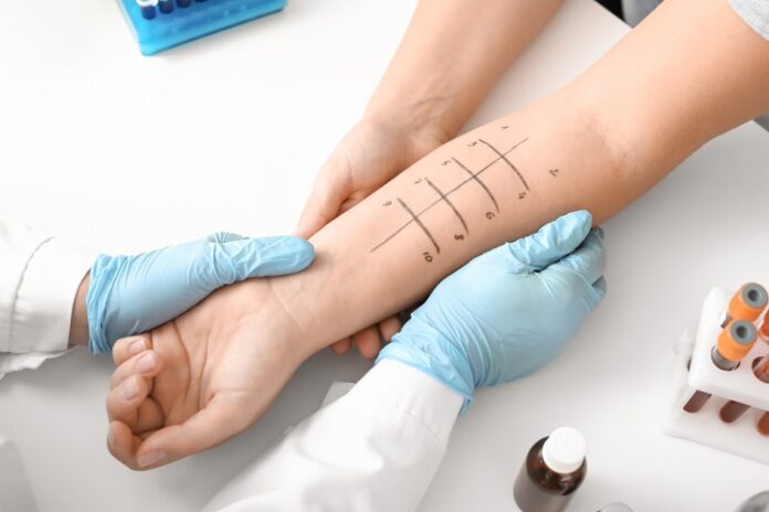Allergy Testing